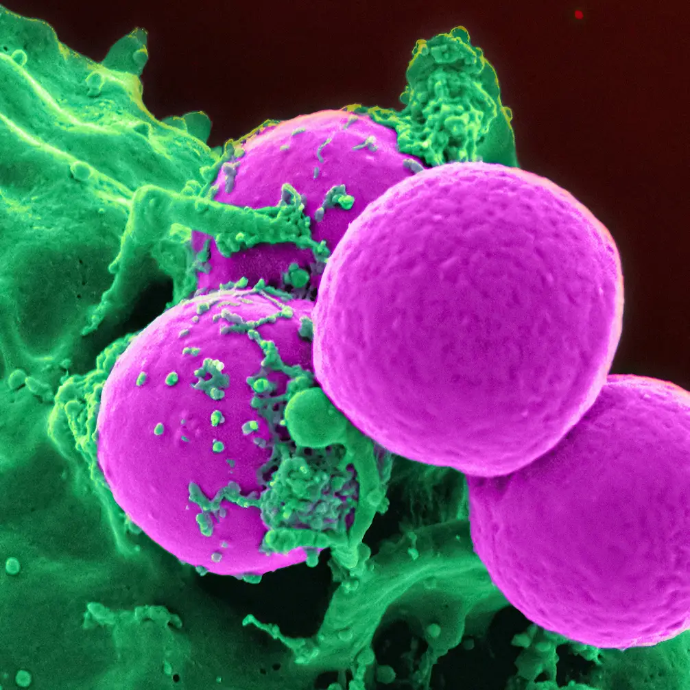 antibiotic-resistant-staph-