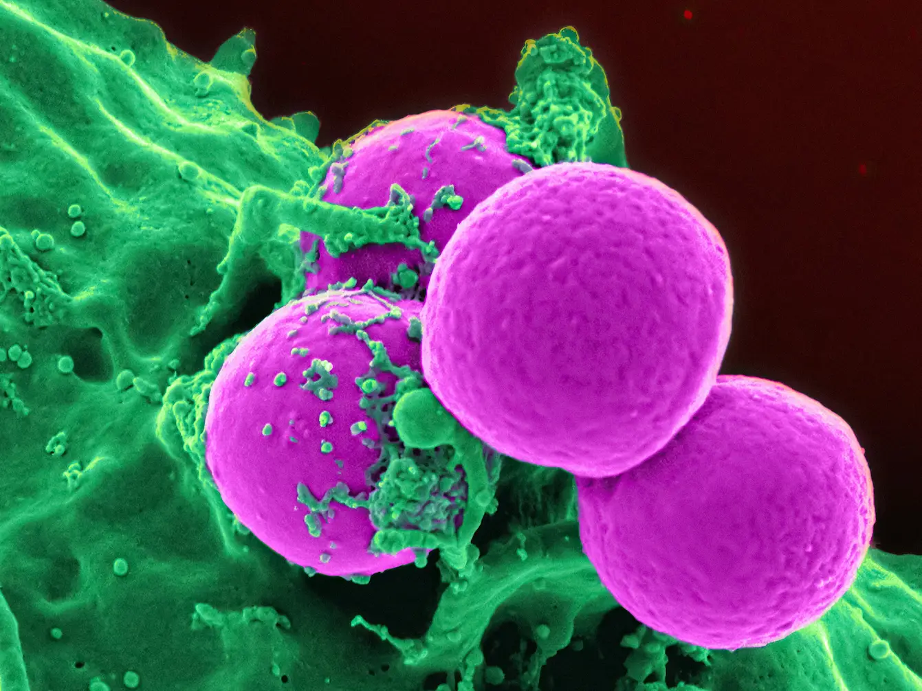 Forget Antibiotics: These Killer Cells Wipe Out Deadly Superbugs