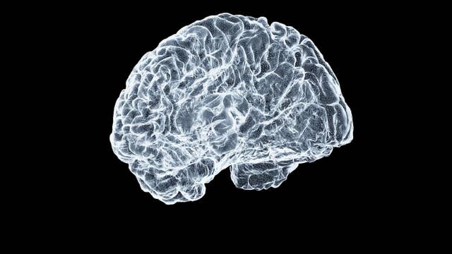 Reviving Brain Activity After ‘Cryosleep’ Inches Closer in Pioneering Study A digital brain on a black brackground