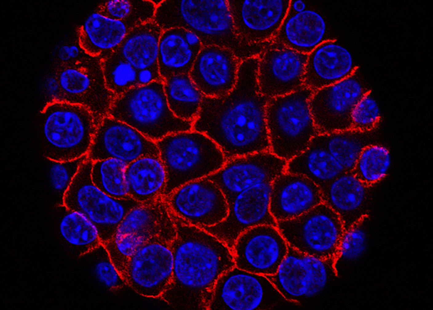 Pancreatic cancer cells