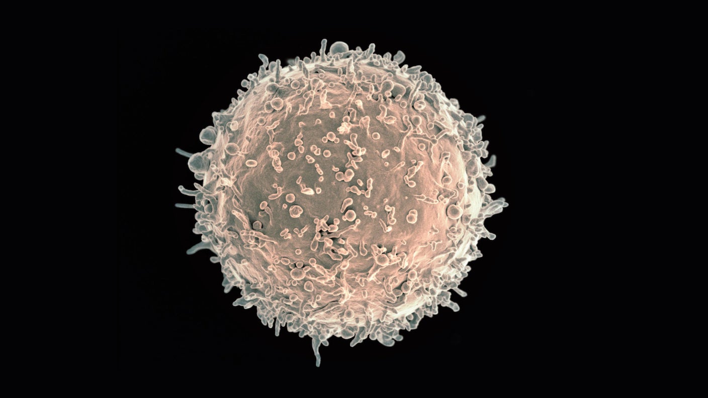 A human B cell