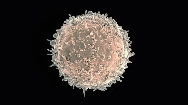 One Shot Just Crushed Three Deadly Autoimmune Diseases A human B cell