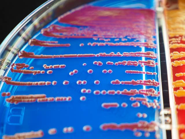 MIT Mined Bacteria for the Next CRISPR—and Found Hundreds of Potential New Tools Bacterial colonies on agar