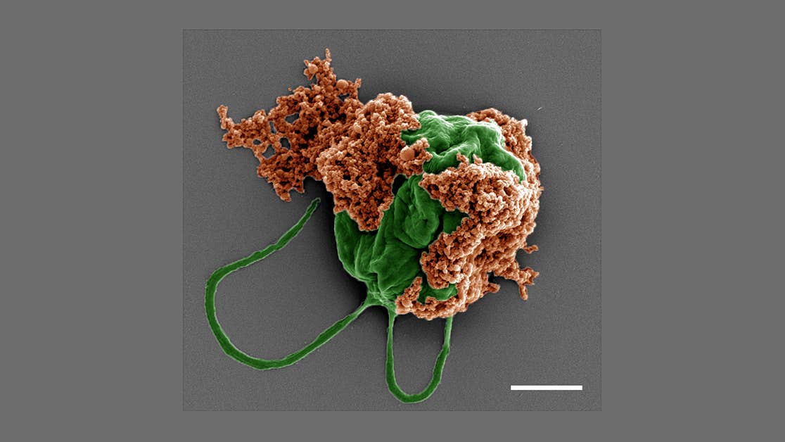 New Algae Robots Swarm Like Locusts at the Flick of a Switch Colored scanning electron microscope image of a microrobot made of an algae cell (green) drug-filled nanoparticles (orange) coated with red blood cell membranes