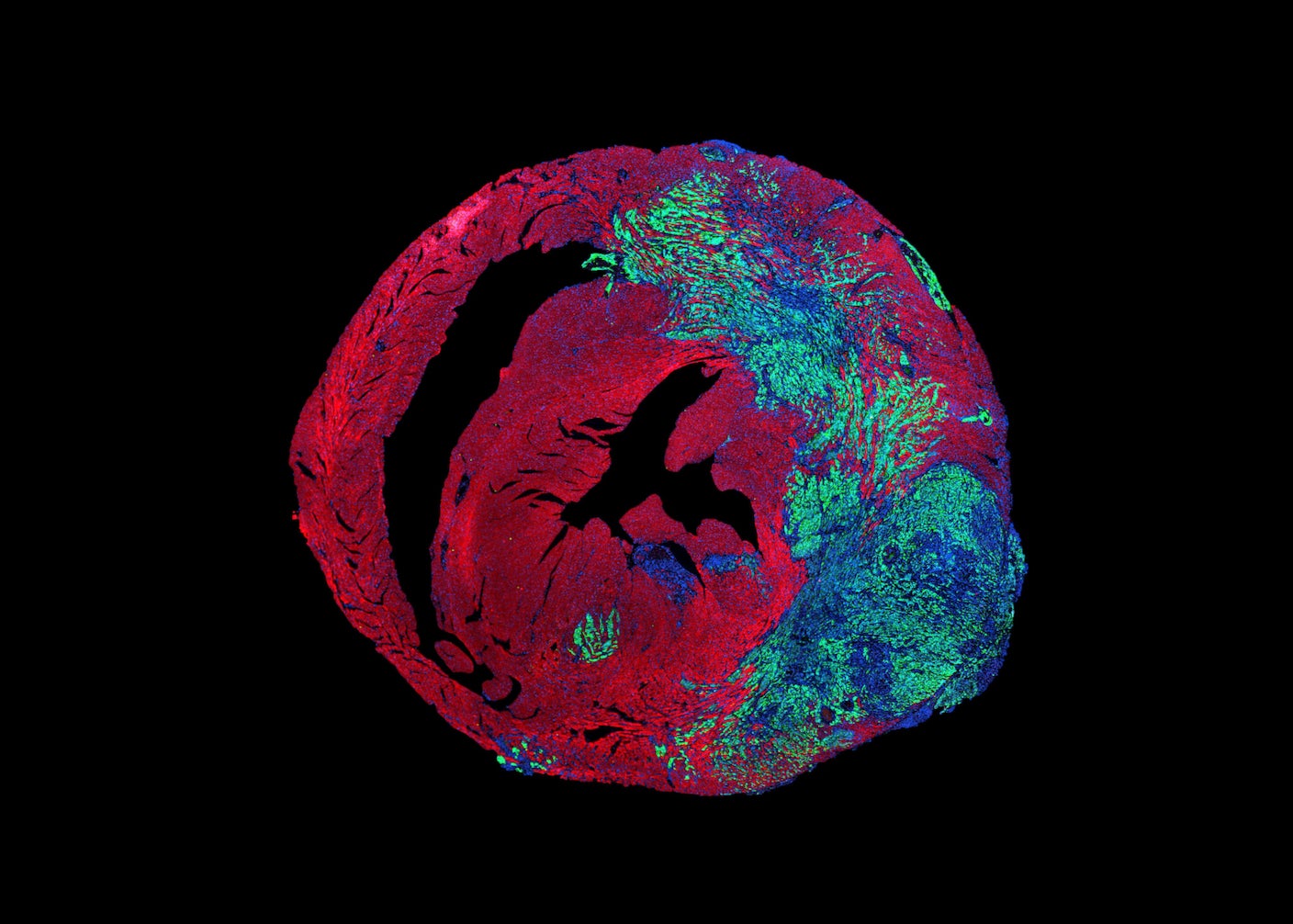 An image of the heart.