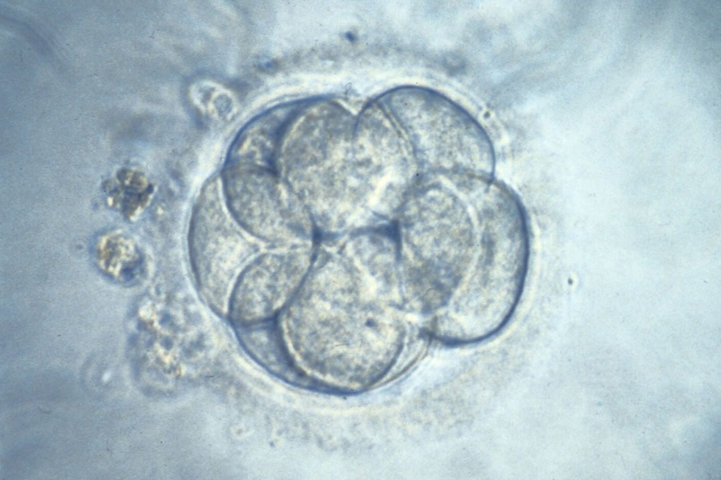 A human embryo.