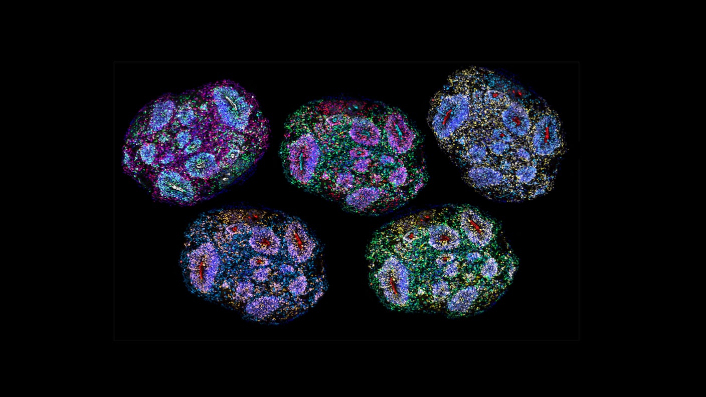 A section of a human brain organoid in false color to show different cell types.