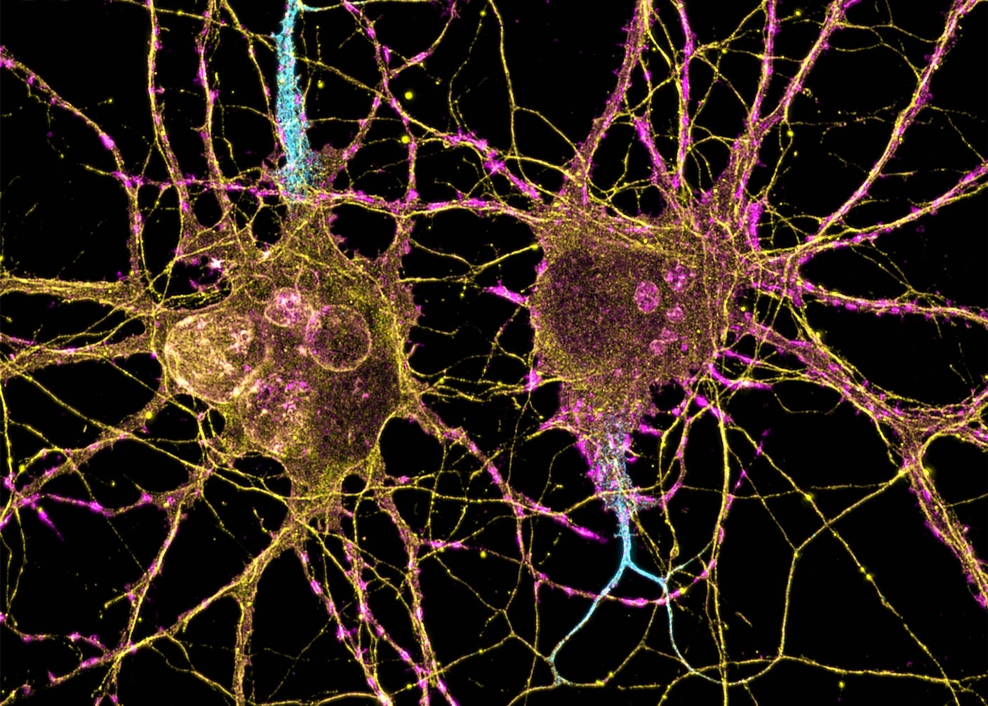 Neurons with branching connections under the microscope.