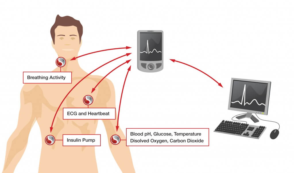 Sensor Sensibility: New Information from Toumaz CEO