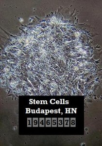 stem-cell-colony-mug-shot
