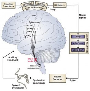 Wireless Device Reads Brain Signals, Turns them into Speech (Video)