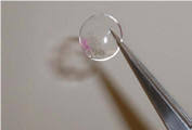 Nanoparticles in a hydrogel lens change color with the glucose level in tears.