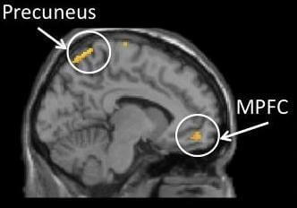 medial-prefrontal-cortex