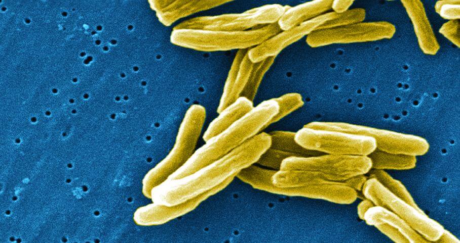 tuberculosis-bacteria - Singularity Hub