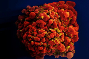 HIV infected T cell.