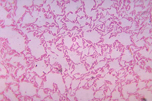 Bacteroides biacutis