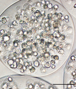 Encapsulated stem cells prior to implantation. There are approximately 200 cells per capsule.