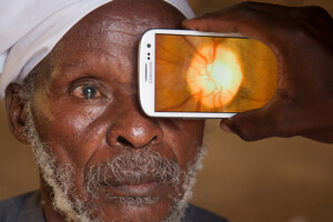 Peek device images a patient's eye 