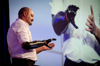 Exponential Medicine: Meet Bionic Amputee, Nigel Ackland