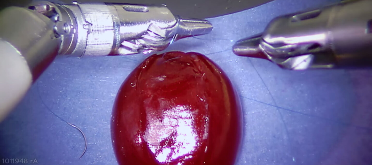 Udlænding Articulation Lover og forskrifter Watch Surgical Robot Deftly Suture a Grape