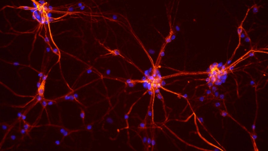 Is the Brain More Powerful Than We Thought? Here Comes the Science