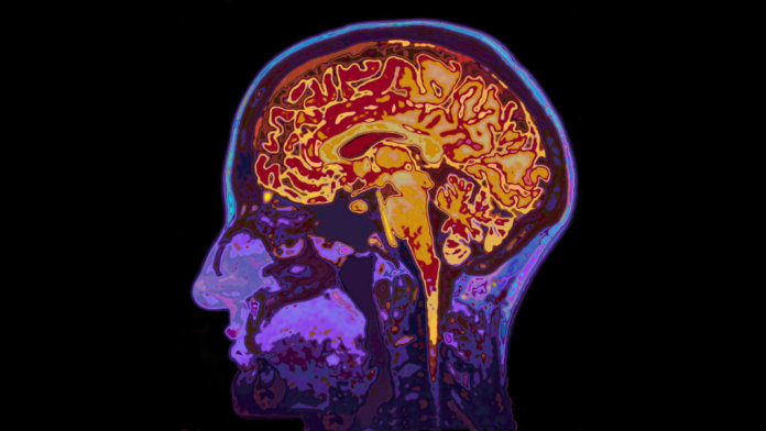 neural-implants-brain-augmentation-mri-image-head-showing-brain-060677413
