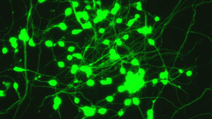 neurons-made-from-blood-cells-green