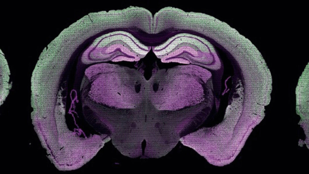 mouse-brain-section-showing-distribution-of-synapse-types