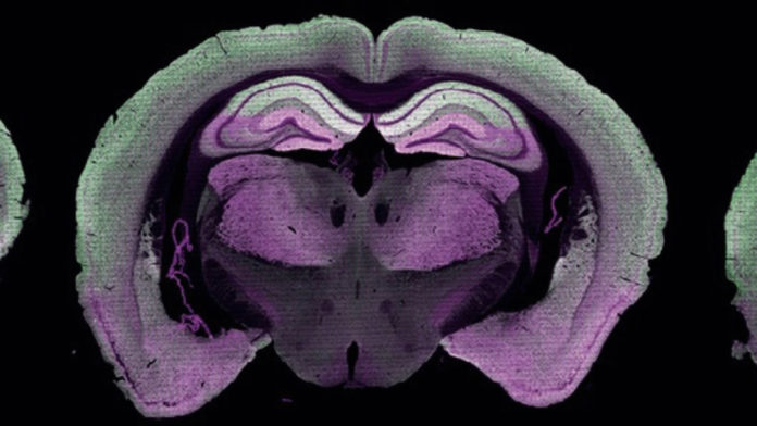 mouse-brain-section-showing-distribution-of-synapse-types