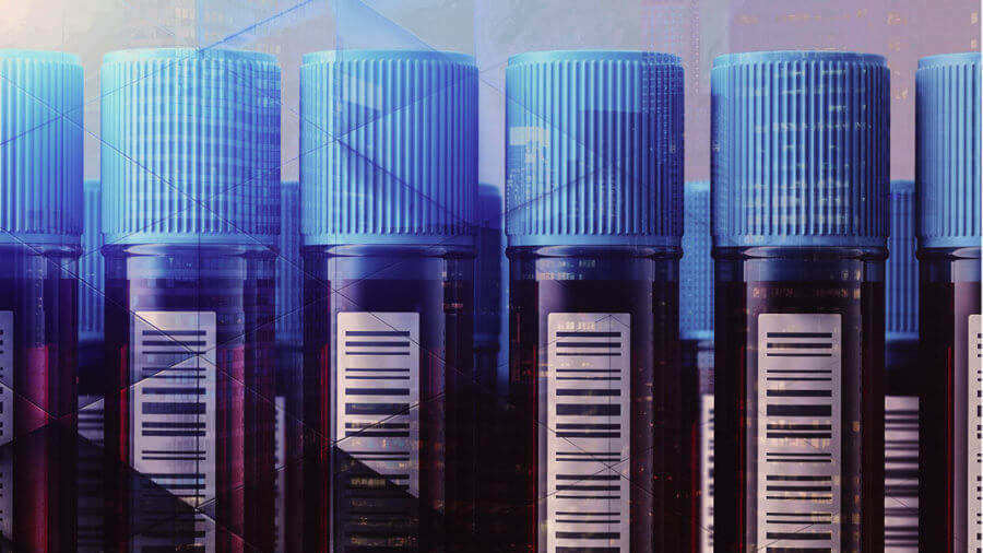 vertical test tubes of blood