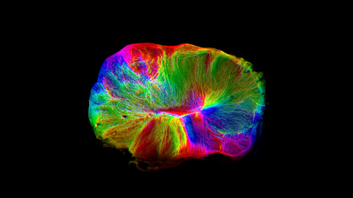 cerebral organoid mini brain hue orientation Lancaster MRC Lab neuroscience