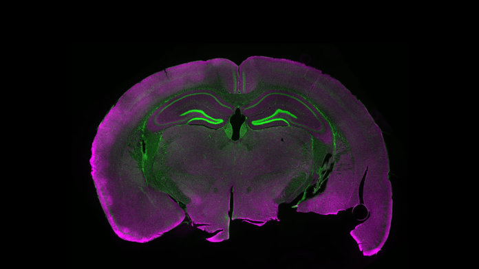 light microscopy of mouse brain with fluorescent labels neuroscience