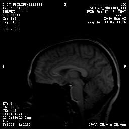 sagittal MRI scan human brain Shelly Fan neuroscience