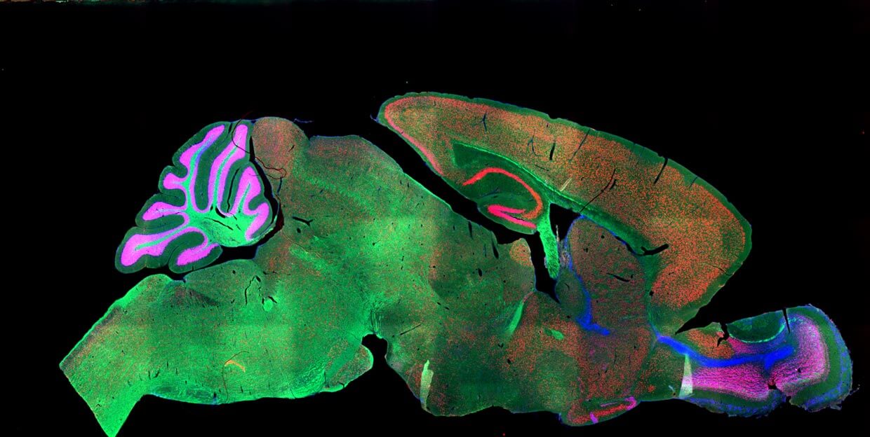 fluorescent stain on mouse brain imaging neuroscience