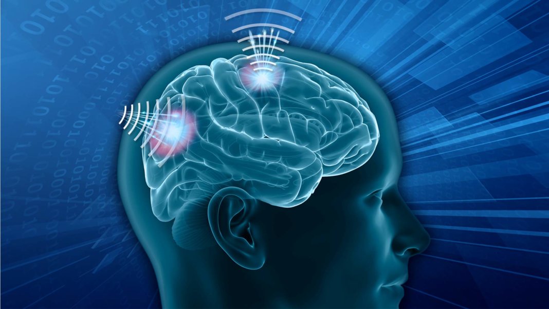 DARPA N3 concept art Brain-Computer Interface