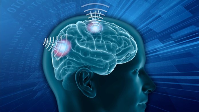 DARPA N3 concept art Brain-Computer Interface