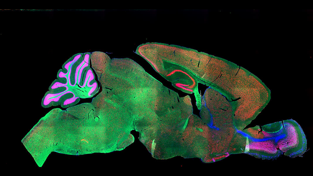 Fluorescent mouse brain imaging neuroscience