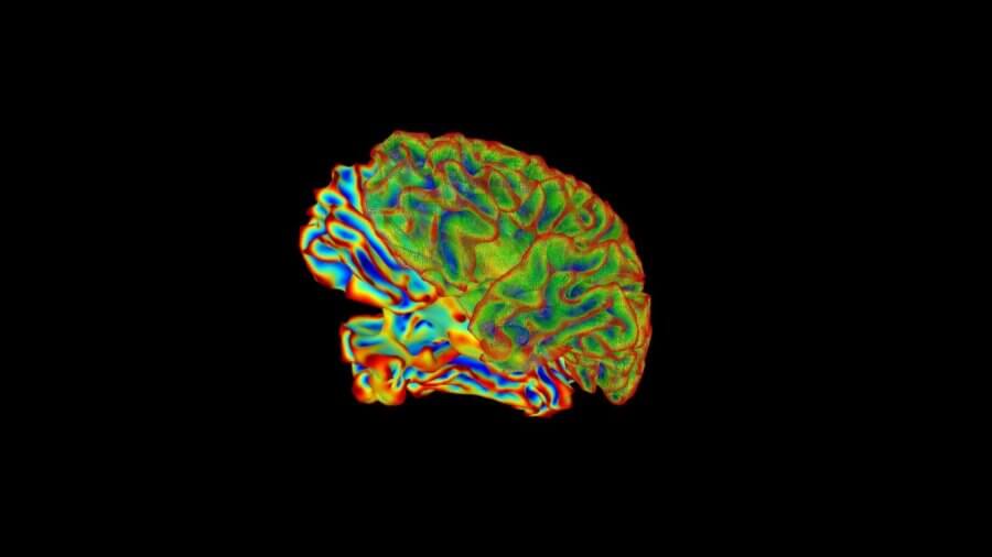 neuroscience multicolored brain imaging