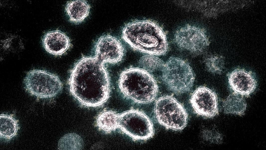 coronavirus Covid-19 virus NIH