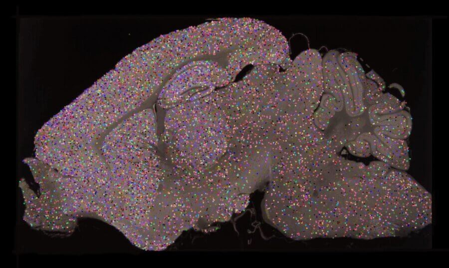 adult mouse brain synapse view