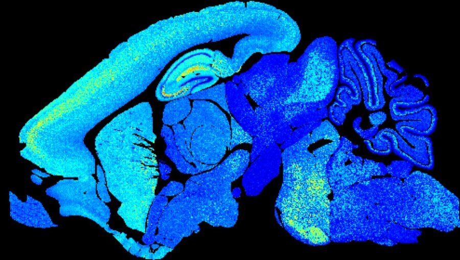 young mouse brain synapse diversity