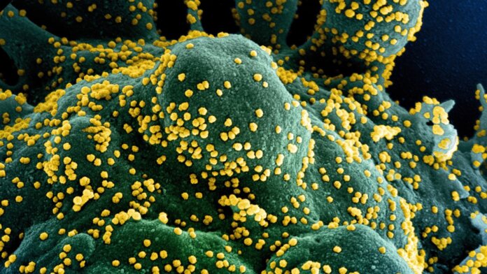 coronavirus sars-cov-2 infects cell electron micrograph blue yellow