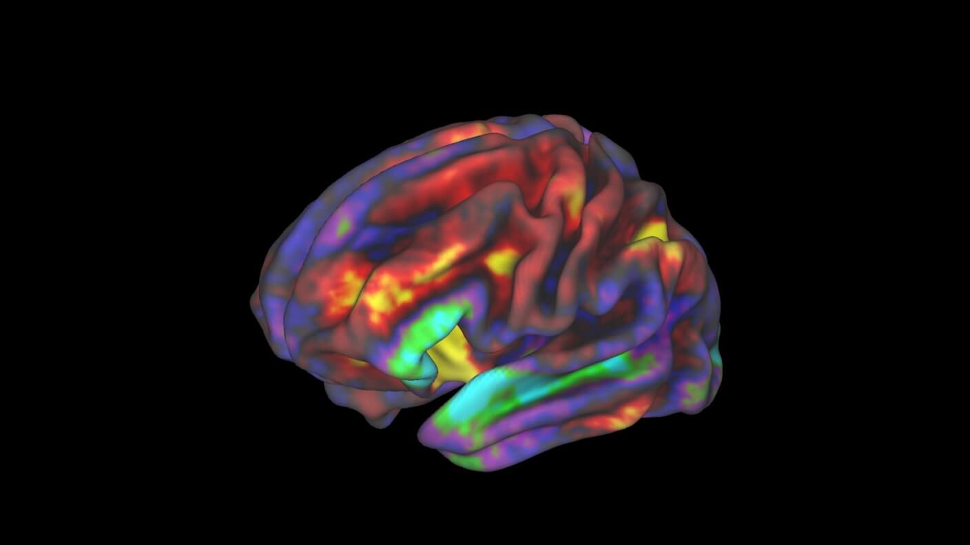 Brain old. 3d Atlas Brain. 3d Brain ai. 3d Нейровизуализация это.