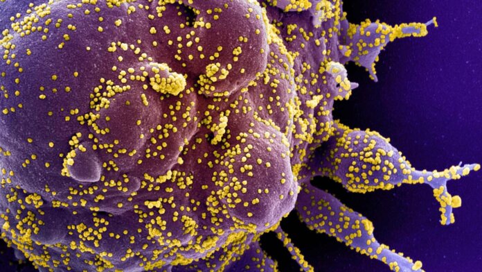 coronavirus pandemic sars-cov-2 sem purple nih