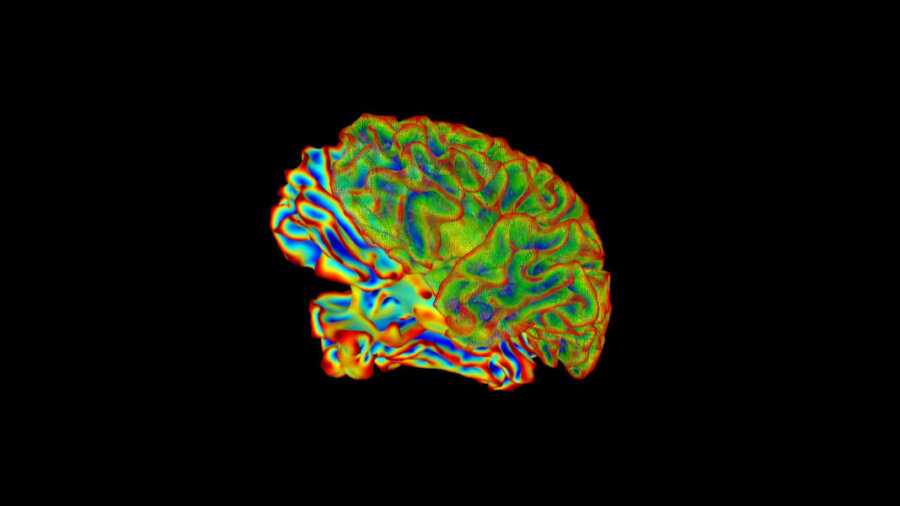 ai brain neuroscience whole brain image nih