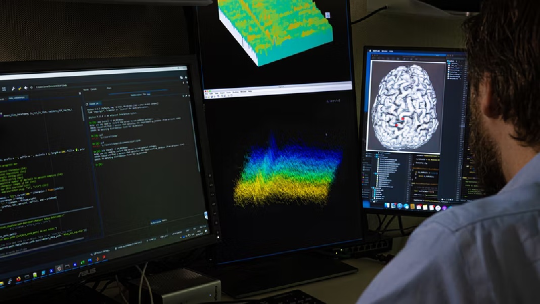 brain implant neurofeedback images