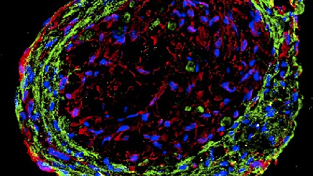 Read more about the article Coronary heart Organoids Tricked Out With Nanowires Restored Coronary heart Operate in Rats