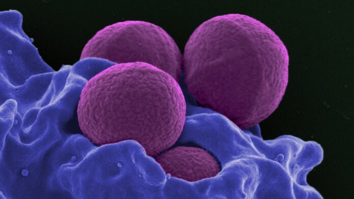 ai antibiotic drugs resistant bacteria superbugs